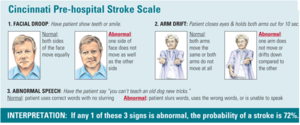 Cincinnati stroke scale.png